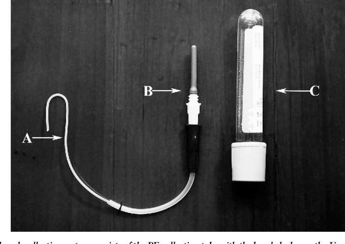 Cabg bypass artery coronary grafting procedure fewer increasingly shorter complications