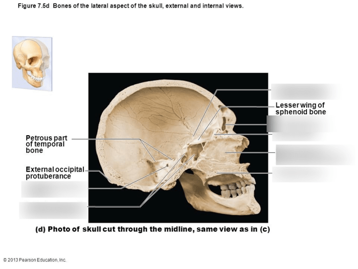 Skull midsagittal labeled craniosacral skeleton nursing